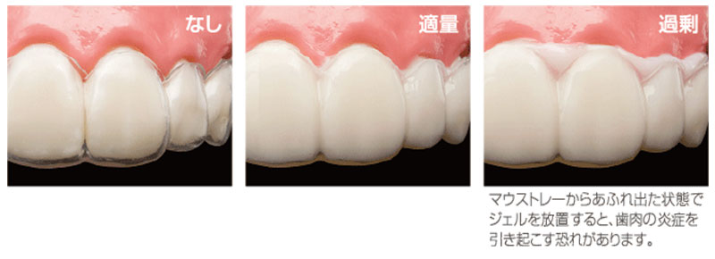 ティオン ホーム プラチナ